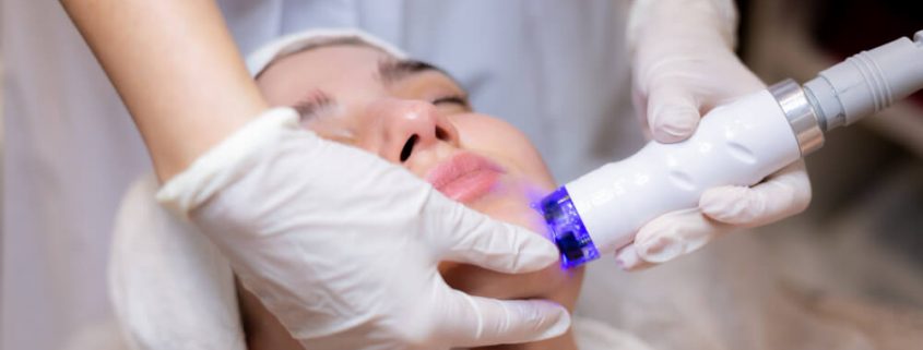 broadband light treatment on skin clinic