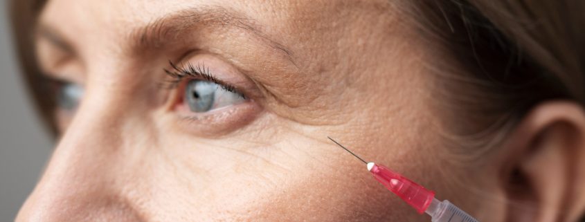 Anti-wrinkle Injection