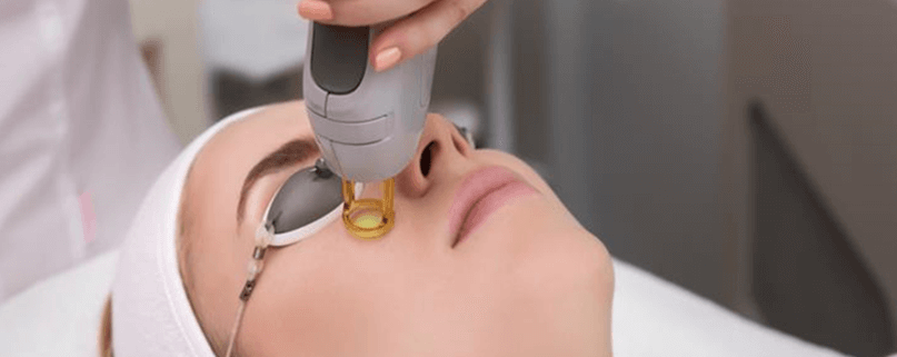 A dermatologist performing laser pigmentation removal on a woman's face using a precision handheld laser device.