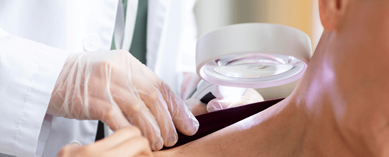 Skin Cancer Check Sydney: Why Early Detection Saves Lives