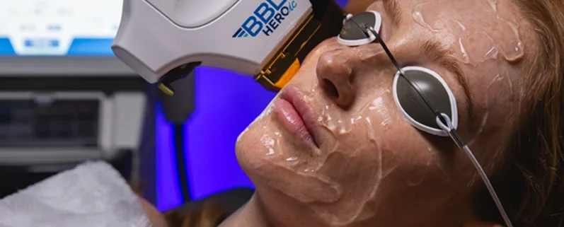 Sciton laser treatment being performed on patient