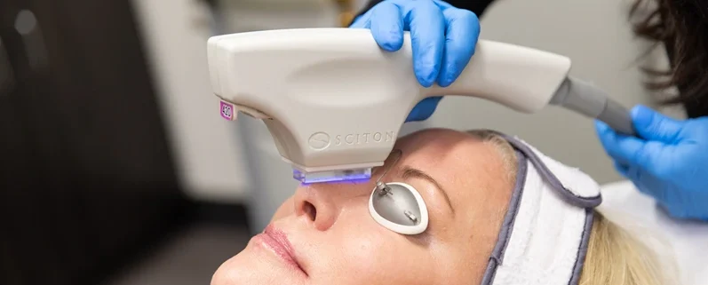 Sciton laser treatment for skin rejuvenation on patient