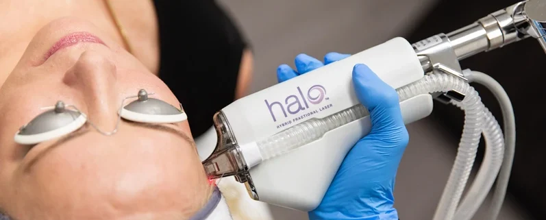 Sciton laser therapy for reducing facial wrinkles