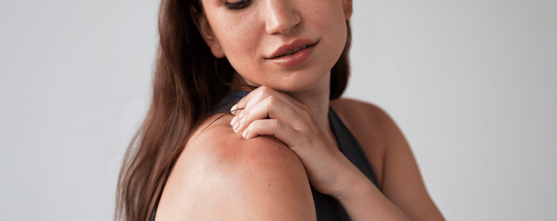 Hives Treatment: How to Find Relief from Itchy Welts