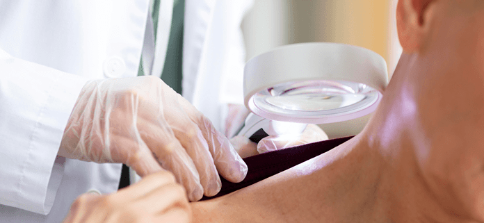 A dermatologist examining a patient for signs of skin cancer at a melanoma skin cancer clinic.