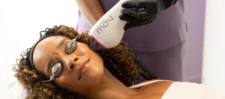 Patient receiving Sciton HALO laser treatment